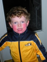 red-cheeked boy