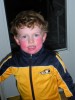 red-cheeked boy